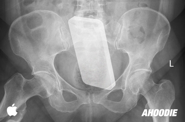 scan your ass Scan your ass